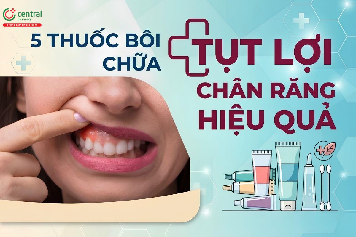 5 thuốc bôi chữa tụt lợi chân răng hiệu quả. Chữa tụt lợi hết bao nhiêu tiền?
