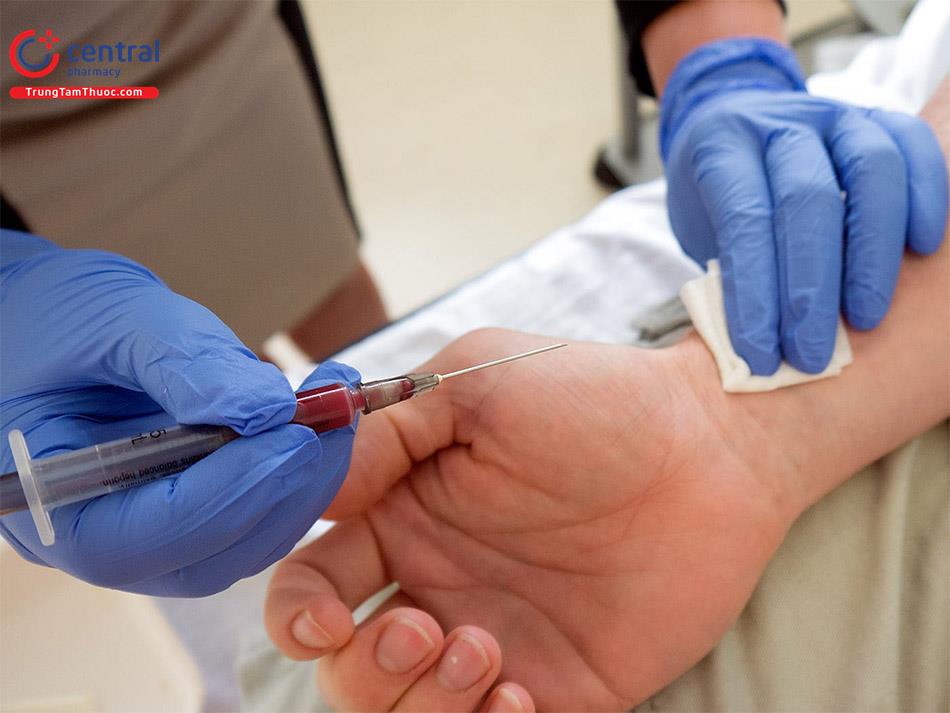 Cấu trúc của máy xét nghiệm khí máu, phương pháp kiểm soát chất lượng khí máu