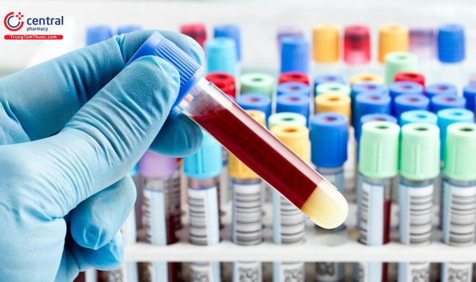 Cấu trúc của máy xét nghiệm đông máu và biện pháp kiểm soát chất lượng xét nghiệm đông máu