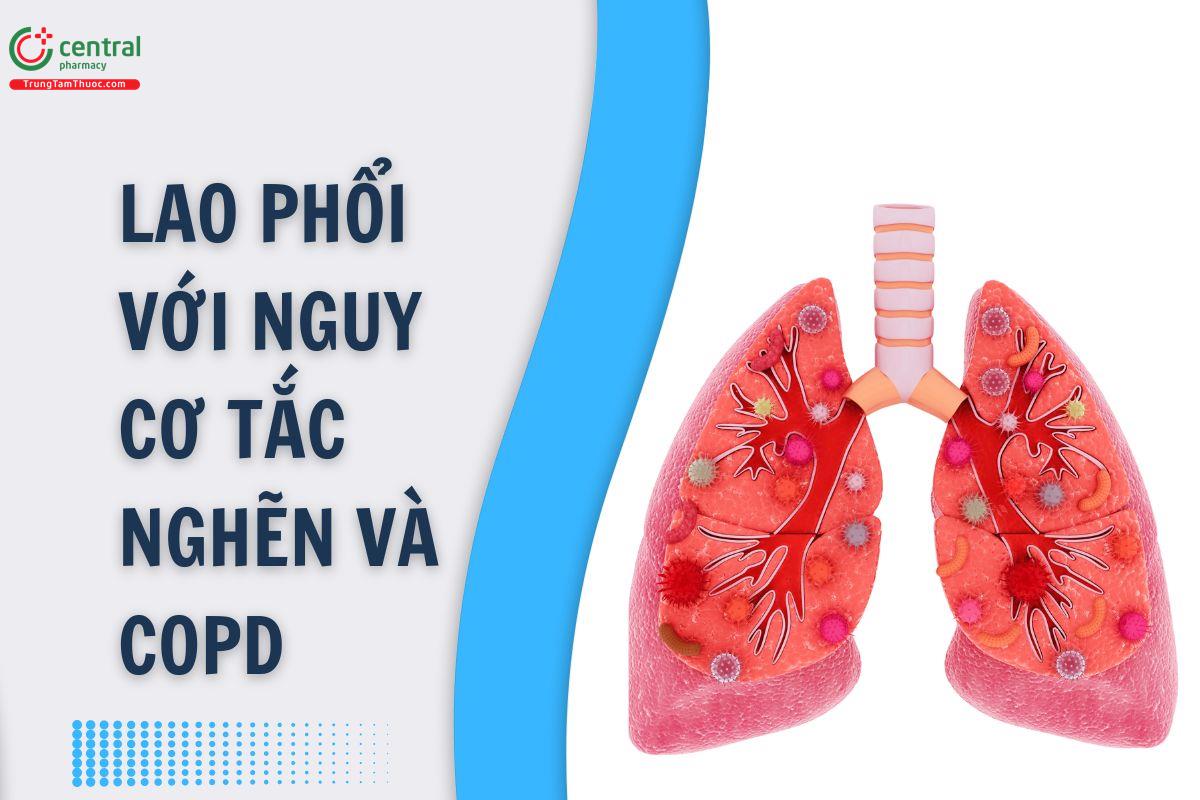 Bài viết tổng quan Lao phổi với nguy cơ tắc nghẽn và COPD