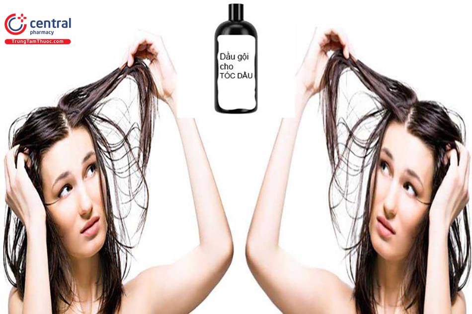 [BẠN NÊN BIẾT] 5 loại dầu gội đầu dành cho tóc và da đầu nhiều dầu