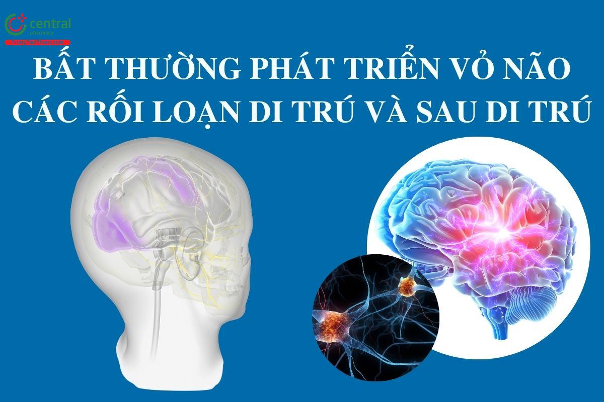 Bất thường phát triển vỏ não: các rối loạn di trú và sau di trú