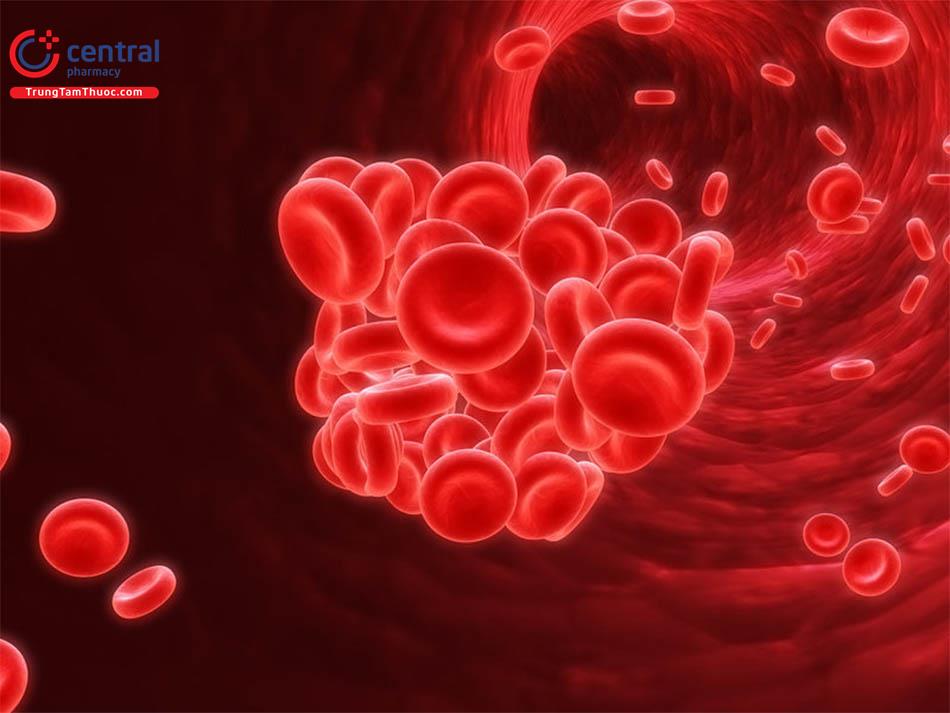 Bệnh đa hồng cầu nguyên phát: Nguyên nhân, chẩn đoán và điều trị