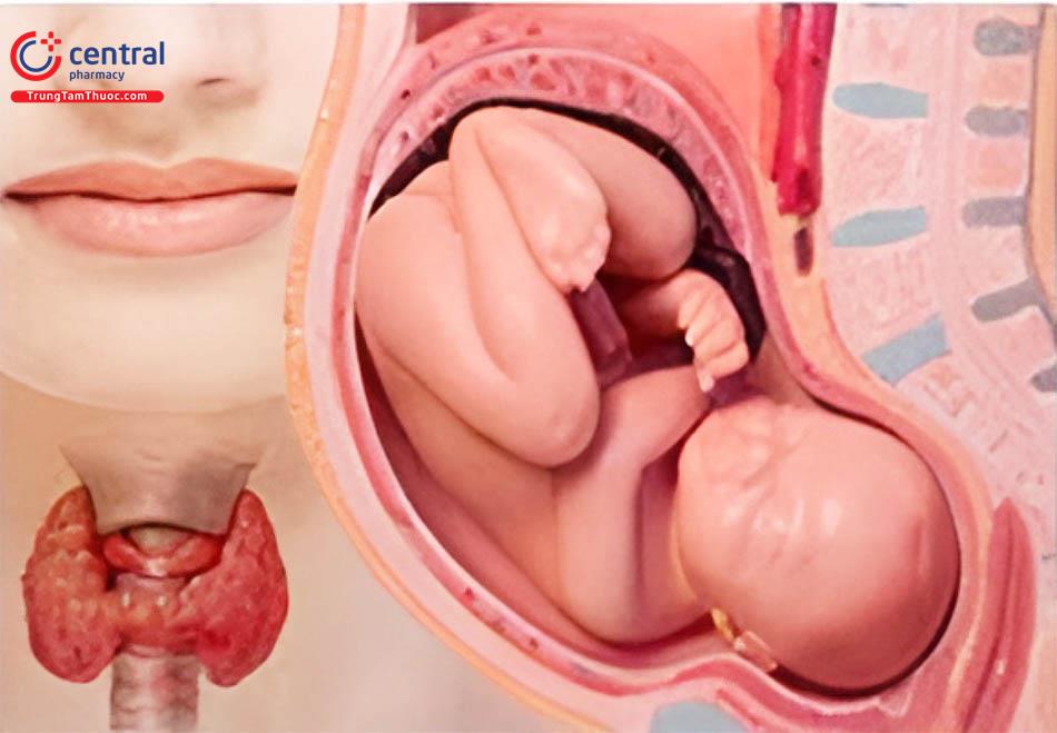 Chuẩn đoán và quản lý bệnh lý tuyến giáp trong thai kỳ 