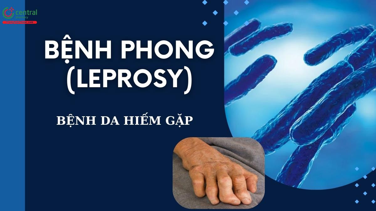 Bệnh phong (Leprosy): nguyên nhân, chẩn đoán và cách điều trị