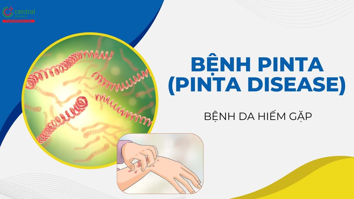 Biểu hiện, cách chẩn đoán và điều trị bệnh Pinta (Pinta disease)
