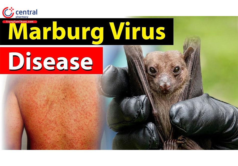 Virus Marburg - Lời cảnh báo về một bệnh dịch nguy hiểm mới