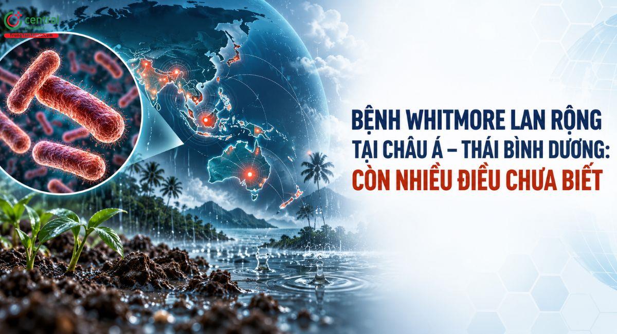 Bệnh Whitmore lan rộng tại châu Á - Thái Bình Dương: Còn nhiều điều chưa biết