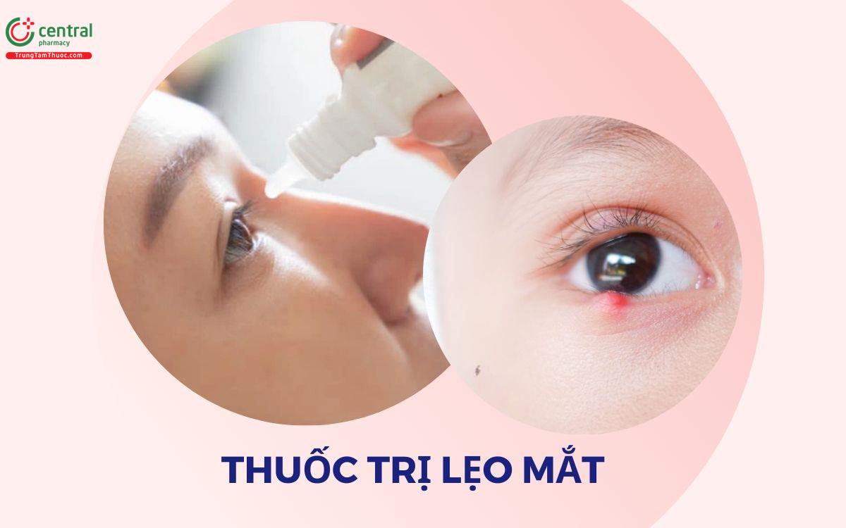 Bị lẹo mắt bôi thuốc gì? Cách trị lẹo mắt hiệu quả chỉ sau 1 đêm