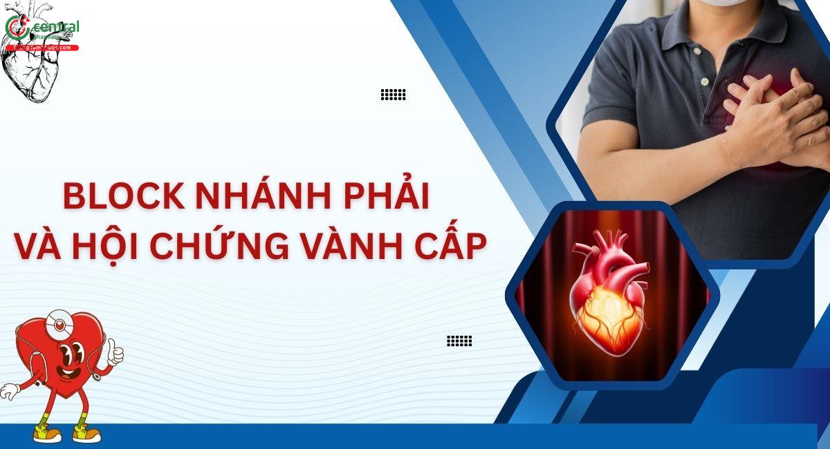 Block nhánh phải và hội chứng vành cấp – Những điều bác sĩ cấp cứu không được quên
