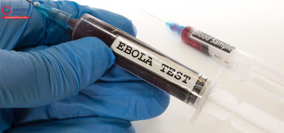 Cách chủ động phòng tránh bệnh truyền nhiễm do virus Ebola