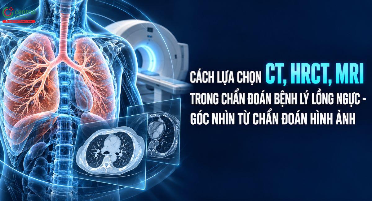 Cách lựa chọn CT, HRCT, MRI trong chẩn đoán bệnh lý lồng ngực - góc nhìn từ chẩn đoán hình ảnh