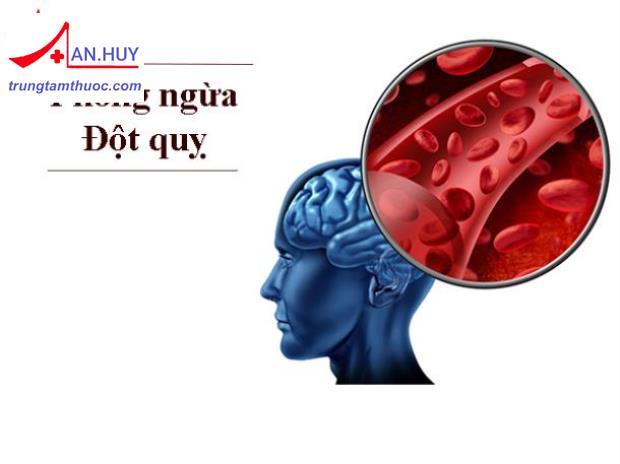 Đột quỵ: định nghĩa, cách phòng ngừa và thuốc điều trị