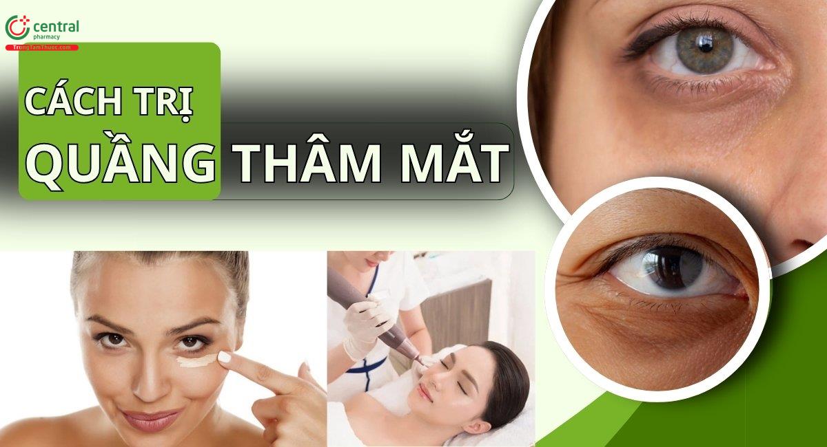 Cách trị quầng thâm mắt tại nhà hiệu quả và an toàn