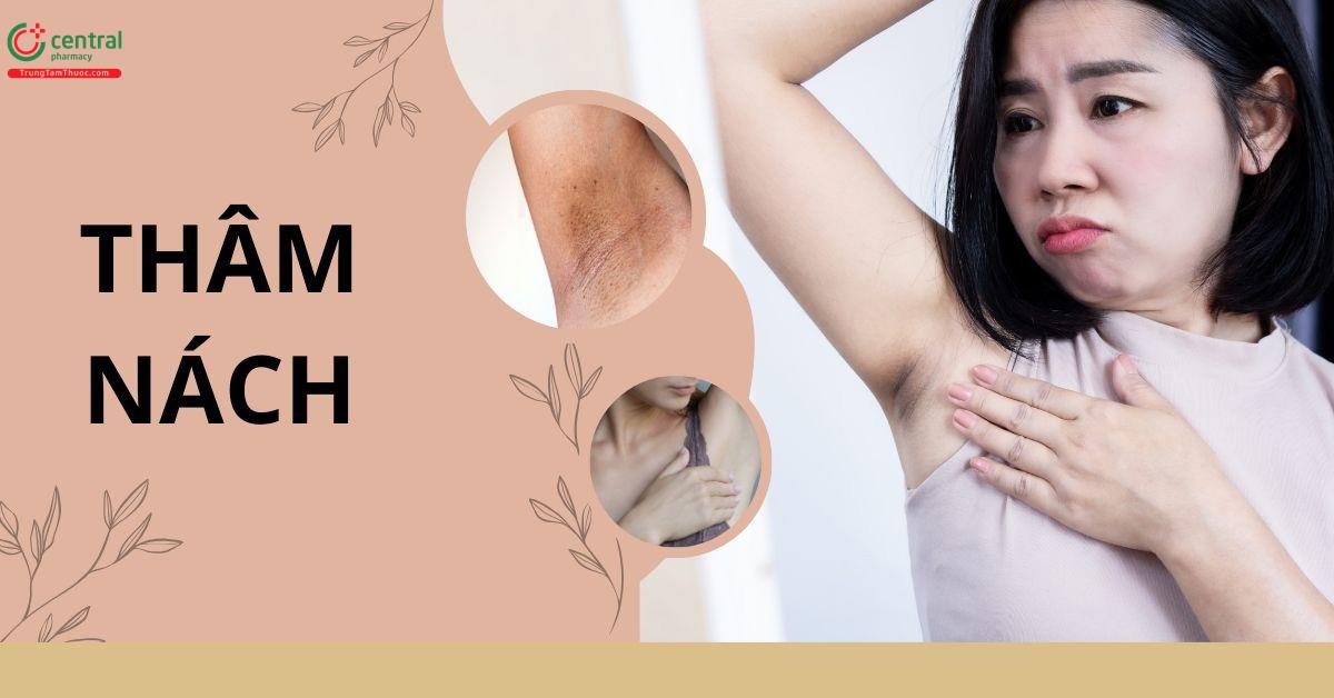 Tại sao nách bị thâm? Cách trị thâm nách trong 3 ngày giúp bật tone bất ngờ