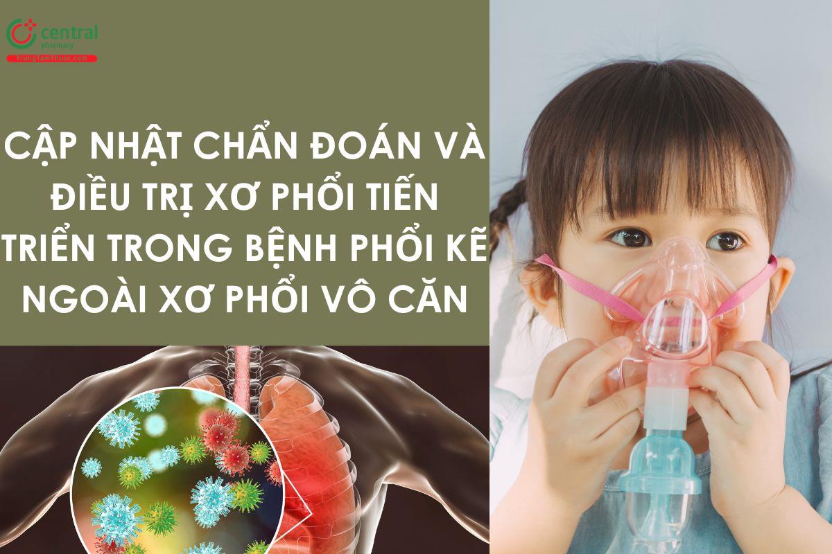 Cập nhật chẩn đoán và điều trị xơ phổi tiến triển trong bệnh phổi kẽ ngoài xơ phổi vô căn