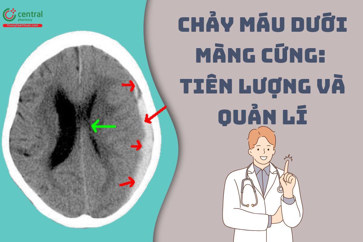 Chảy máu dưới màng cứng: Tiên lượng và quản lí, phương pháp điều trị