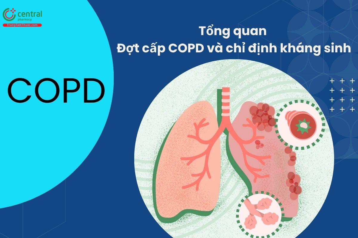 Tổng quan: Đợt cấp COPD và chỉ định kháng sinh