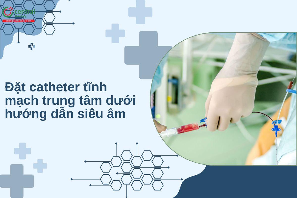 Đặt catheter tĩnh mạch trung tâm dưới hướng dẫn siêu âm