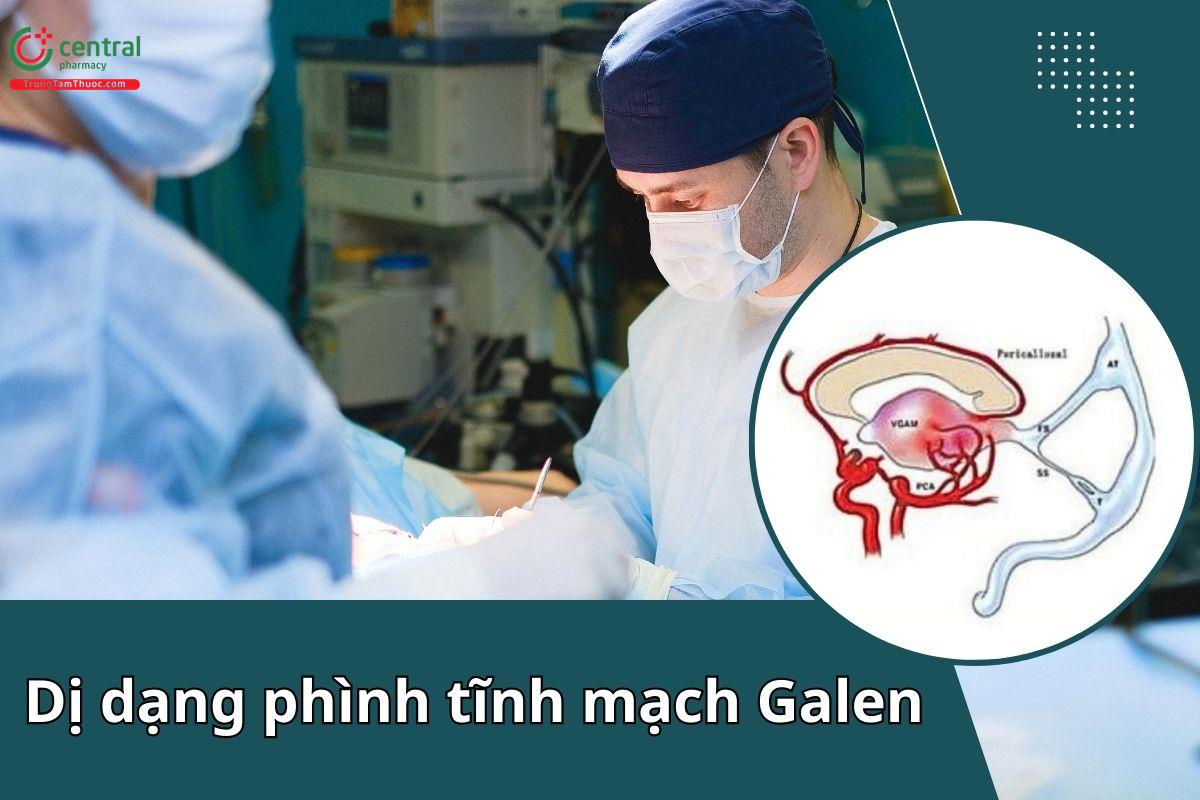 Dị dạng phình tĩnh mạch Galen (VGAM): Tổng quan cập nhật