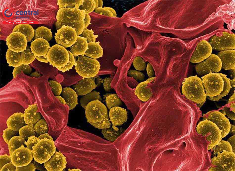 Điều trị và dự phòng nhiễm trùng do tụ cầu vàng Staphylococcus