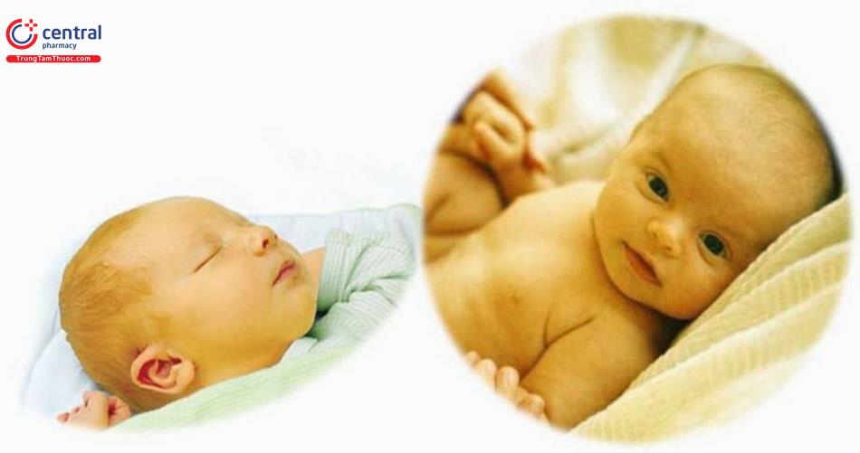 Điều trị vàng da tăng bilirubin gián tiếp ở trẻ sơ sinh