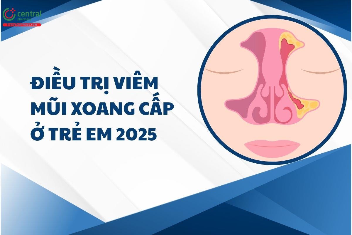 Bệnh viêm mũi xoang cấp ở trẻ em: nguyên nhân, hướng dẫn điều trị 2025