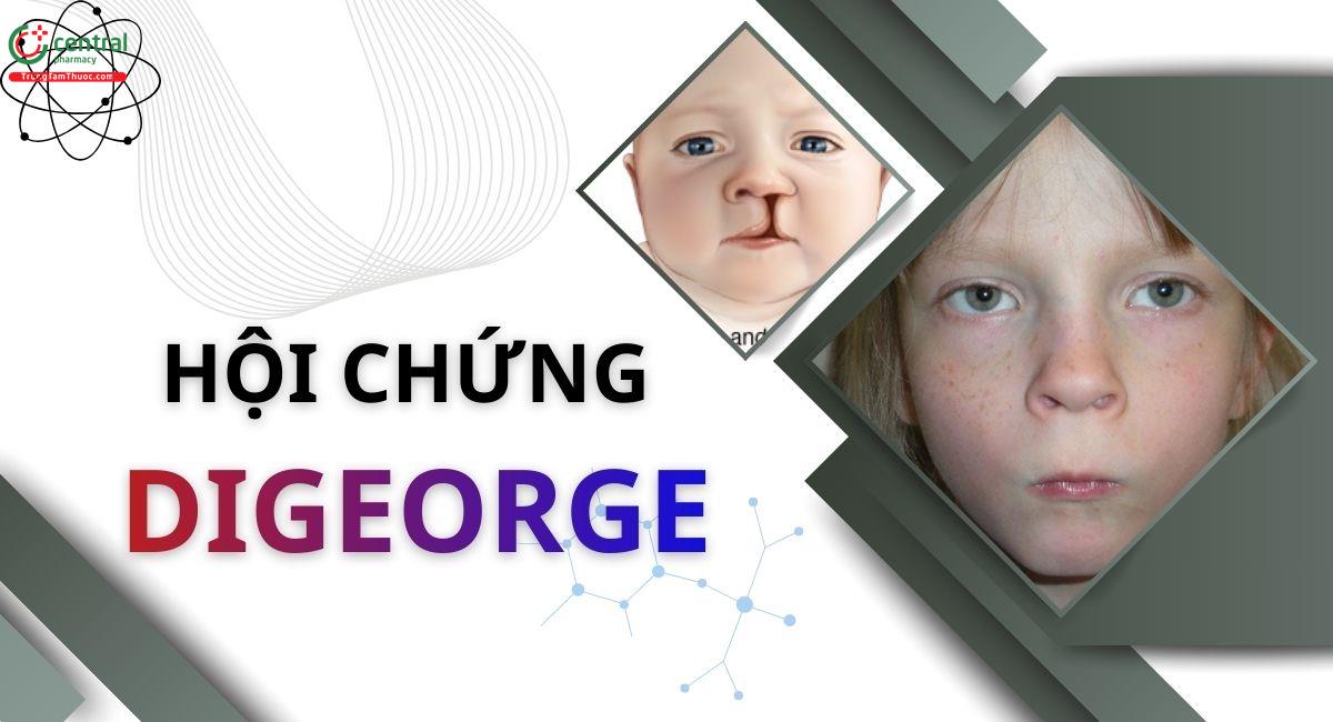 Hội chứng DiGeorge là gì, có di truyền không? Nguyên nhân, triệu chứng và cách điều trị