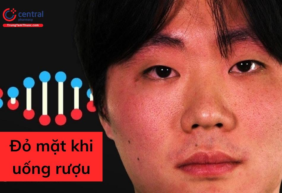 Đỏ mặt khi uống rượu cảnh báo nguy cơ mắc ung thư vòm họng