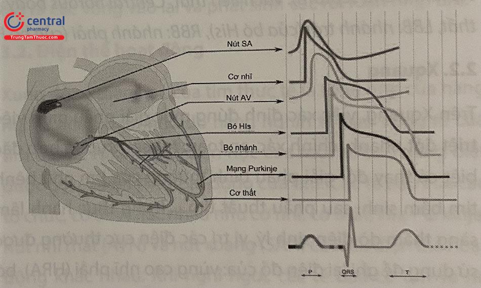 Giải phẫu và sinh lý hệ thống dẫn truyền ứng dụng trong can thiệp điện sinh lý tim