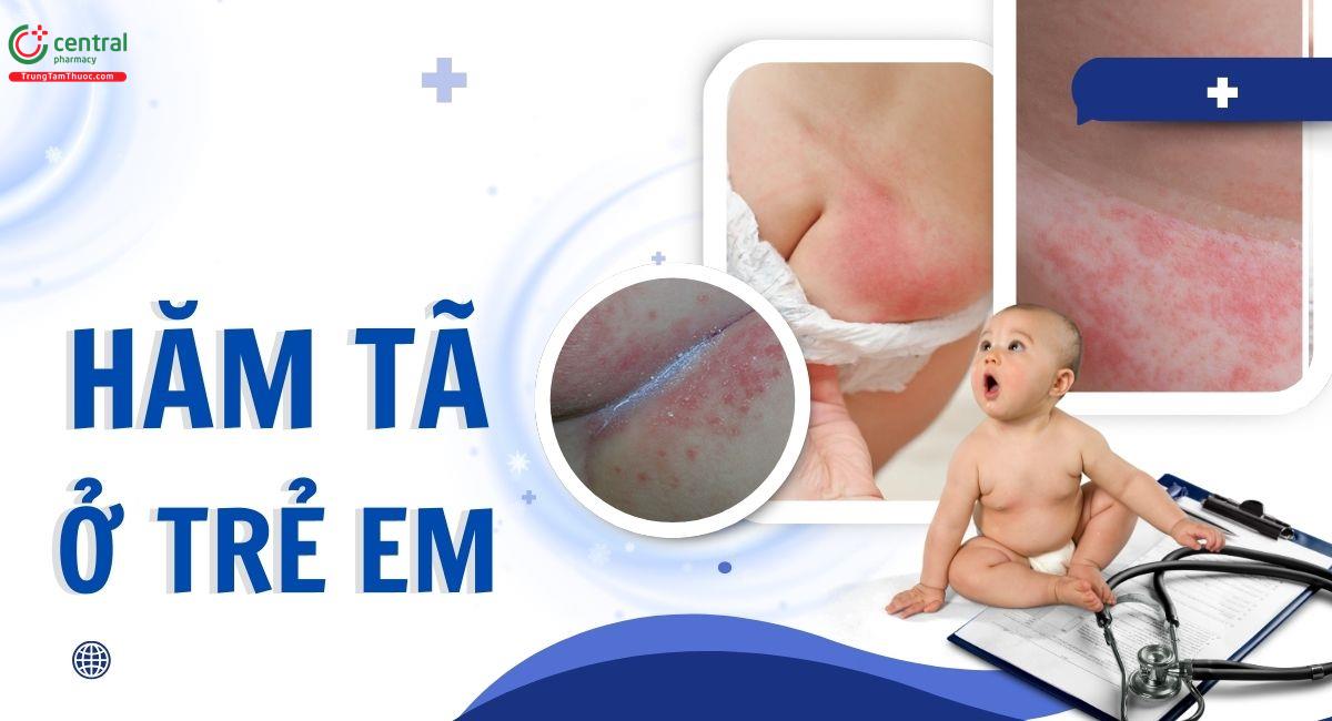 Hăm tã là gì? Nguyên nhân do đâu và cách phòng ngừa bố mẹ nên biết