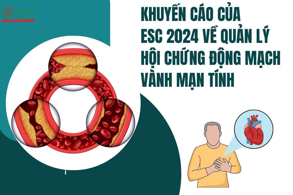 Khuyến cáo của ESC 2024 về quản lý hội chứng động mạch vành mạn tính