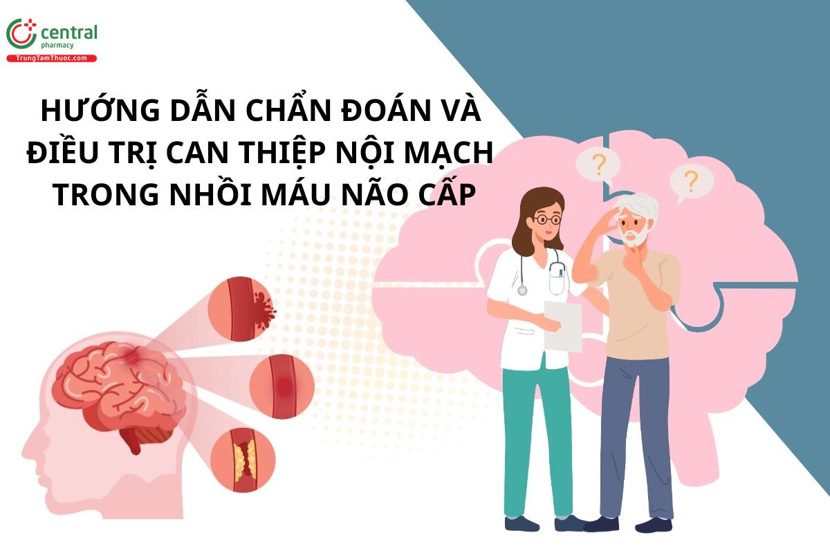 Hướng dẫn chẩn đoán và điều trị can thiệp nội mạch trong nhồi máu não cấp - Bộ Y tế