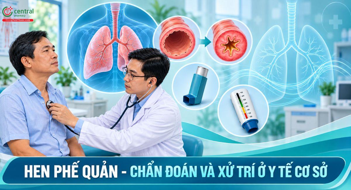 Hen phế quản - Chẩn đoán và xử trí ở y tế cơ sở