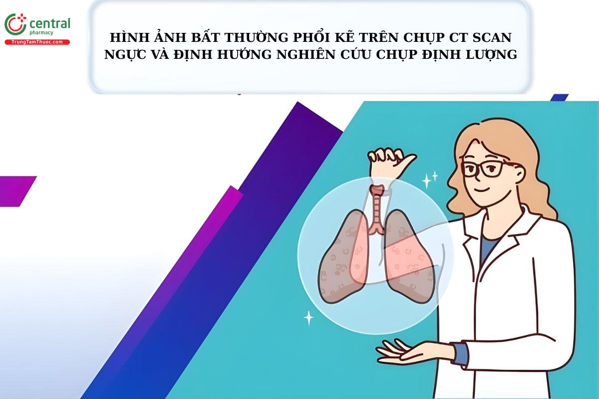 Hình ảnh bất thường phổi kẽ trên chụp CT SCAN ngực và định hướng nghiên cứu chụp định lượng