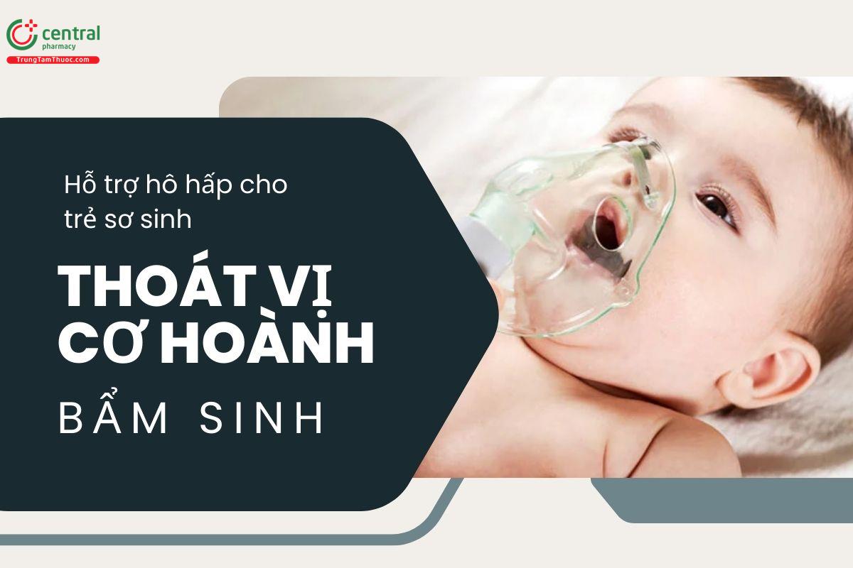 Hỗ trợ hô hấp cho trẻ sơ sinh bị thoát vị cơ hoành bẩm sinh