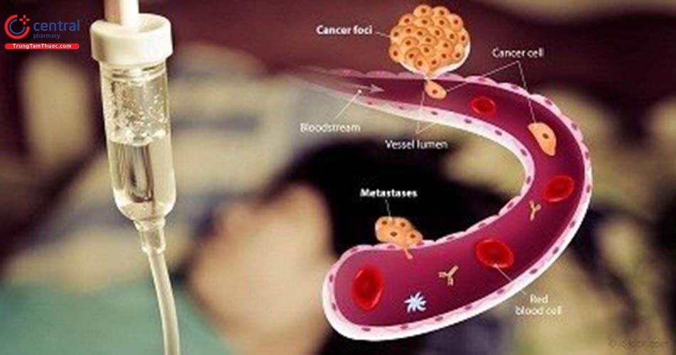 Hóa trị liệu và bài toán điều trị ung thư phụ khoa ở nữ giới