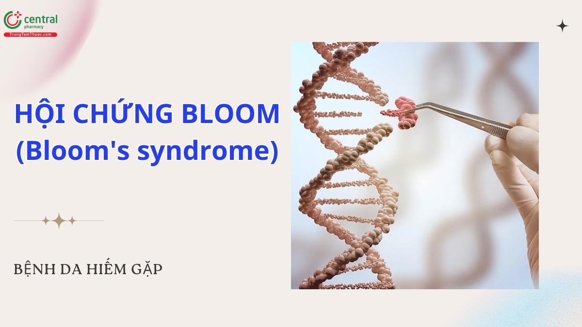 Hội chứng Bloom (Bloom's syndrome) - Tình trạng hiếm gặp do di truyền lặn