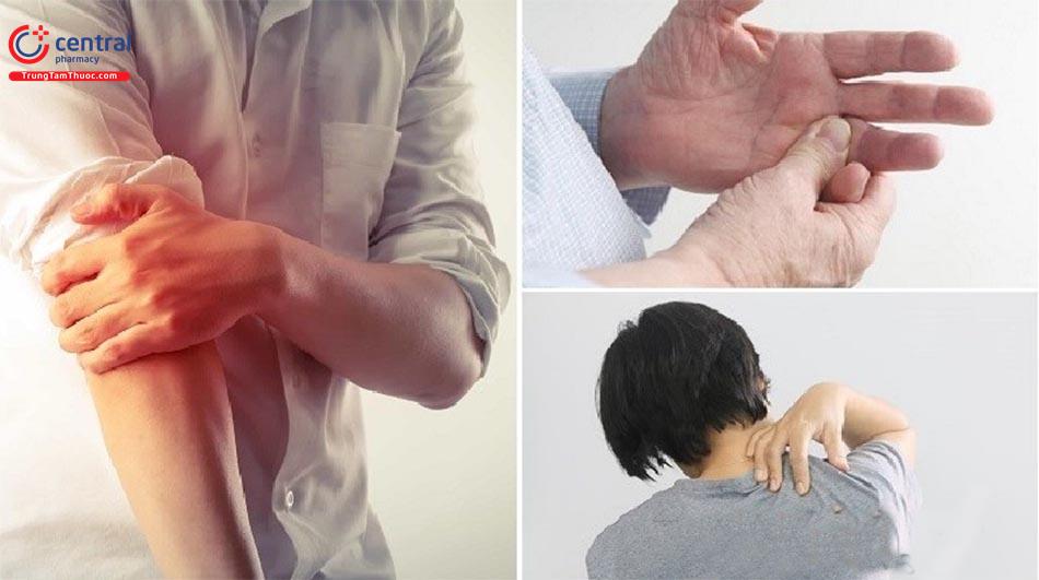 Hội chứng Cổ - Vai - Cánh tay: nguyên nhân, chẩn đoán và điều trị