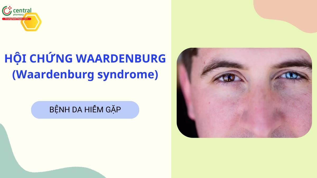 Nguyên nhân, biểu hiện lâm sàng của Hội chứng Waardenburg (Waardenburg syndrome)