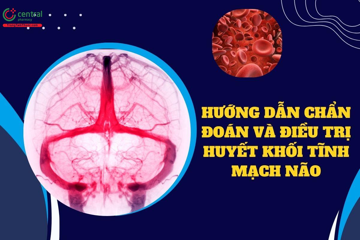 Hướng dẫn chẩn đoán và điều trị huyết khối tĩnh mạch não - Bộ Y tế