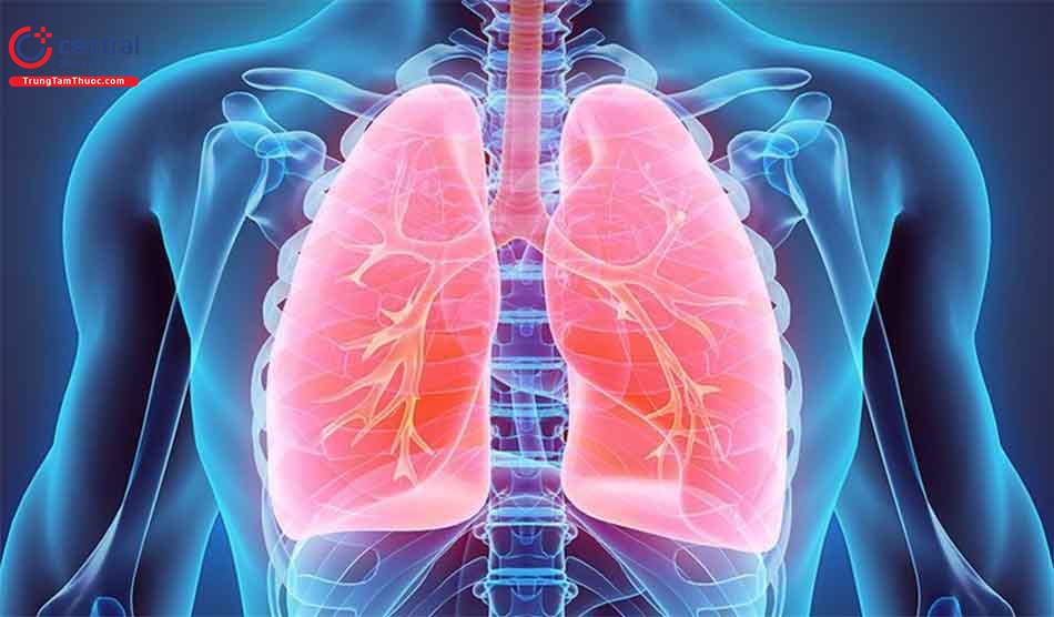 Hướng dẫn chẩn đoán và điều trị viêm phổi không đáp ứng điều trị