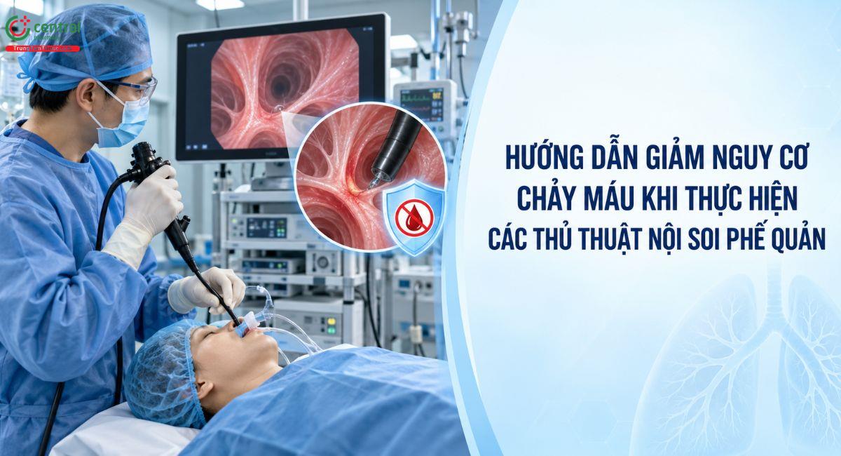 Hướng dẫn giảm nguy cơ chảy máu khi thực hiện các thủ thuật nội soi phế quản