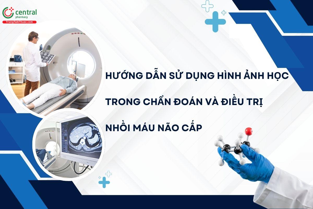 Hướng dẫn sử dụng hình ảnh học trong chẩn đoán và điều trị nhồi máu não cấp - Bộ Y tế