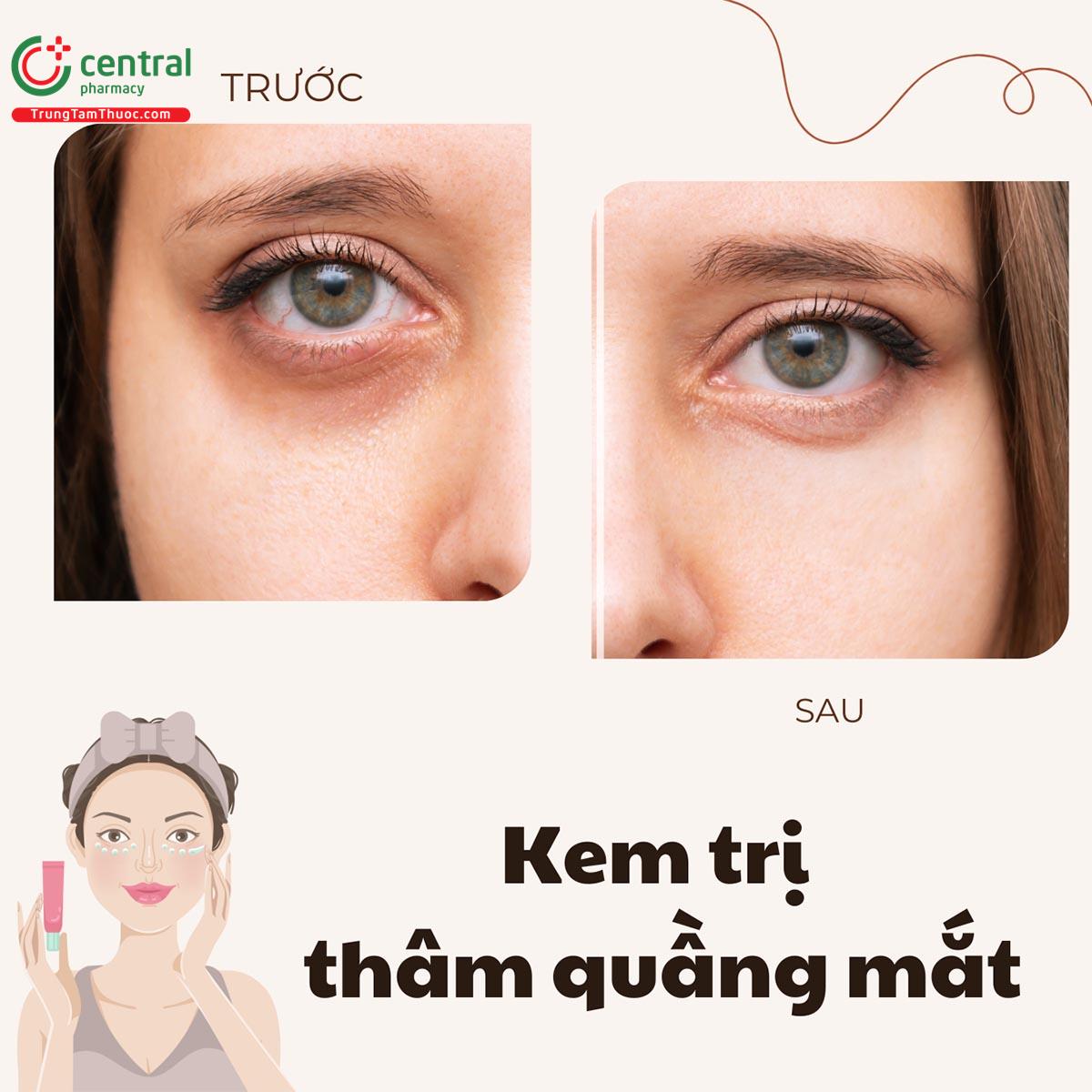 Review 5 loại kem trị thâm quầng mắt hiệu quả, giá học sinh sinh viên