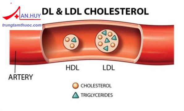 Rối loạn lipid máu: đánh giá rối loạn lipid máu và mức độ nguy hiểm