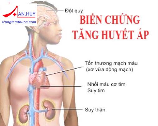 Các dấu hiệu cảnh báo biến cố tim mạch
