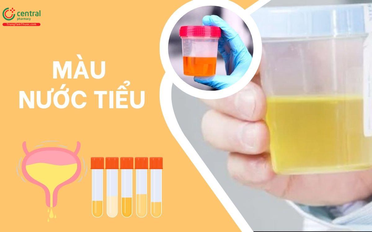 Màu nước tiểu nói lên điều gì? Dấu hiệu nào cảnh báo bệnh cần khám ngay?