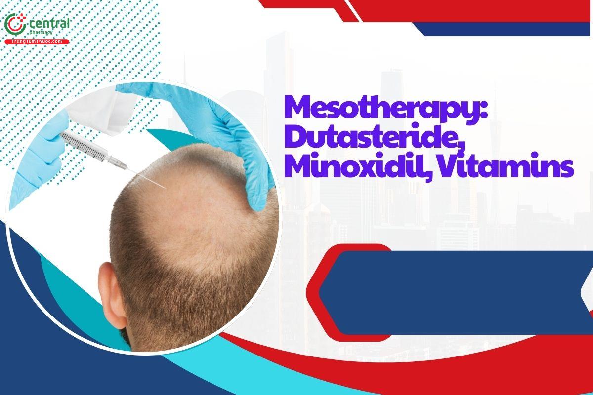 Kỹ thuật tiêm Mesotherapy thuốc Dutasteride, Minoxidil, Vitamins trong điều trị rụng tóc