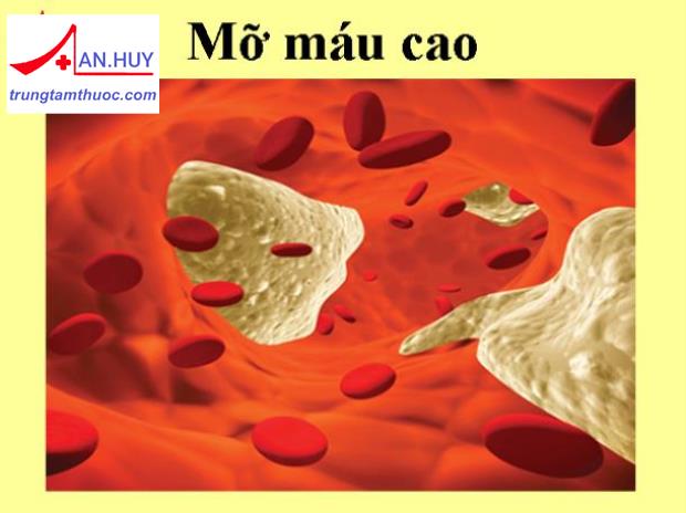 Nguyên nhân và hậu quả của mỡ máu cao (Rối loạn Lipid máu)